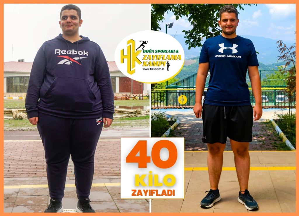 Belçika’dan Geldi 40 Kilo Zayıfladı