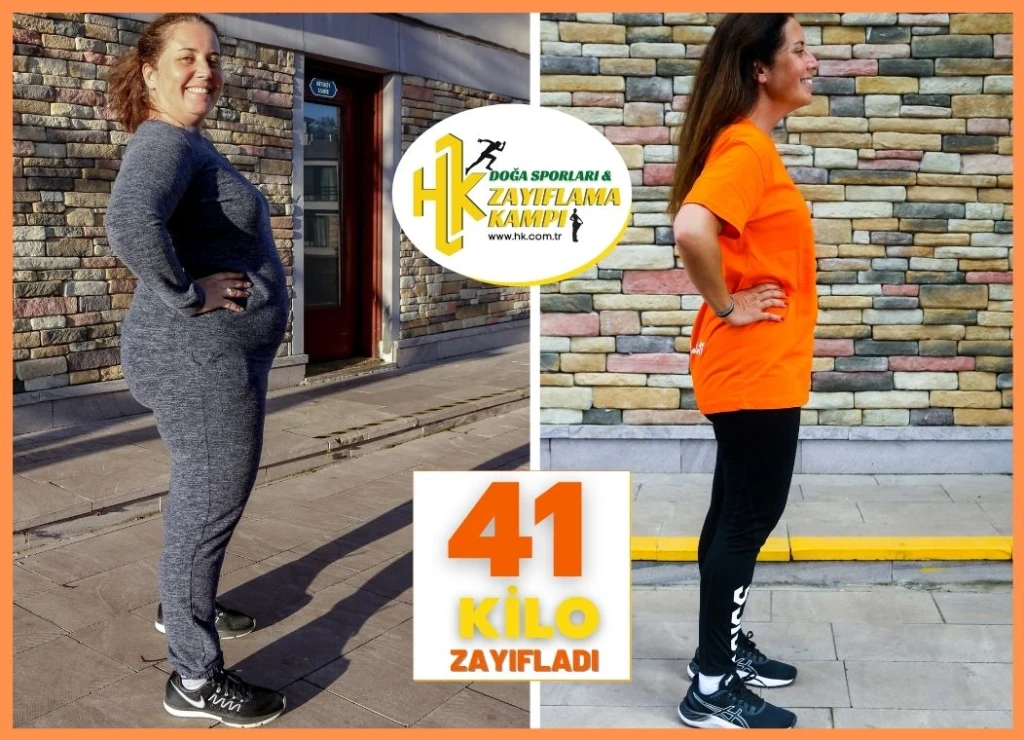 Gülsüm Hanım Tam 41 Kilo Zayıfladı