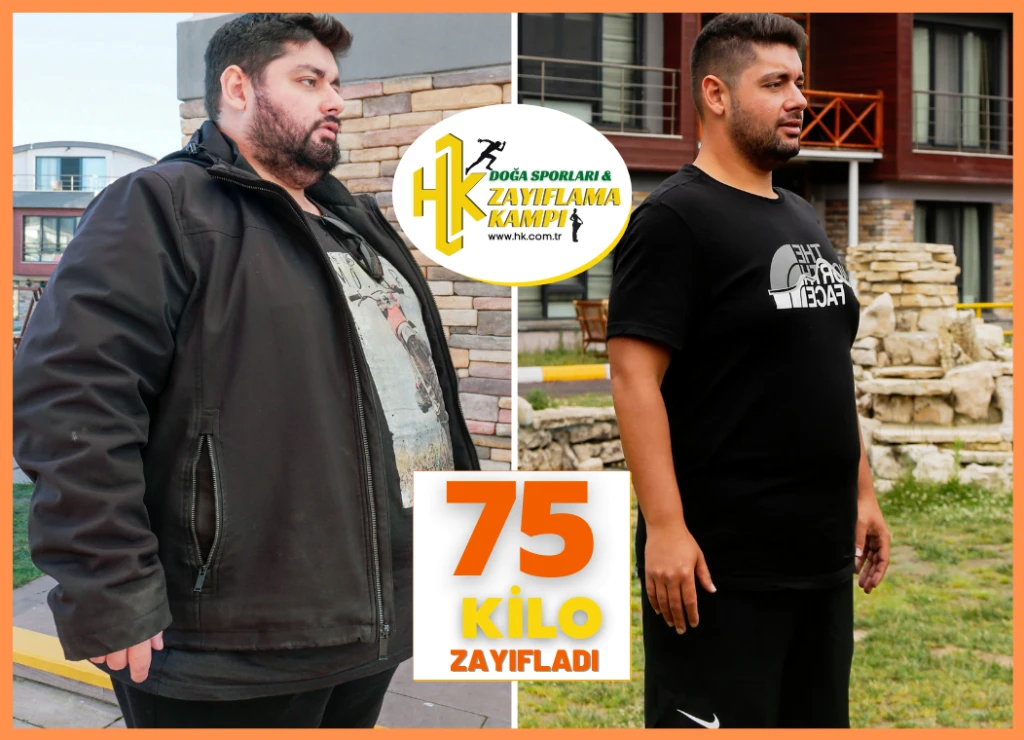 Kampımıza gelen Alican tam 70 Kilo Zayıfladı