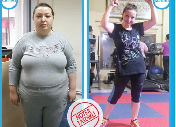 Sedef 62 Kilo Zayıfladı ve Kaderini Değiştirdi